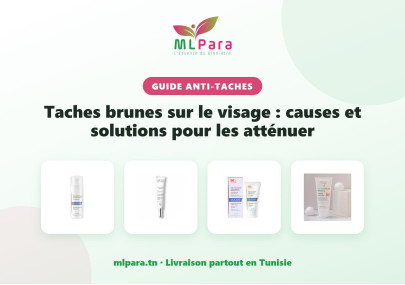 Taches brunes sur le visage : causes et solutions pour les atténuer