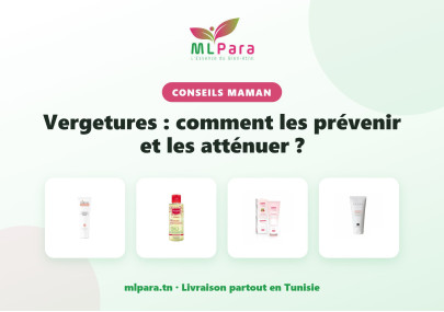 Vergetures : comment les prévenir et les atténuer ?