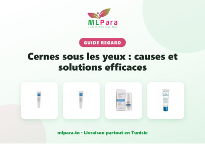 Cernes sous les yeux : causes et solutions efficaces