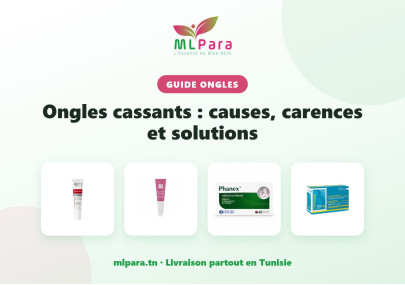 Ongles cassants : causes, carences et solutions